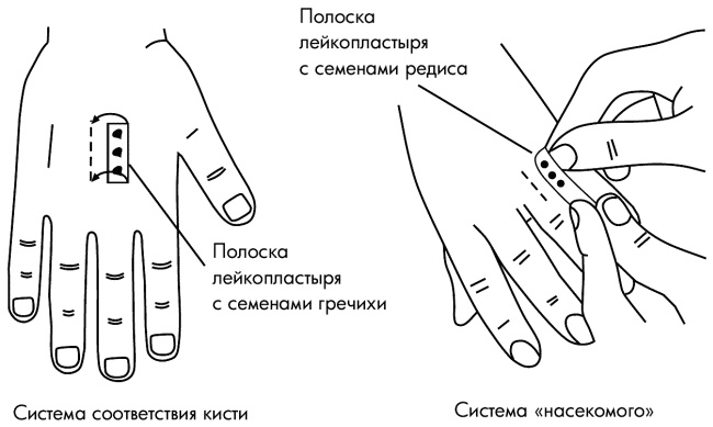 Су-Джок лечит. Мигрень, кашель, боль в спине, тяжесть в желудке