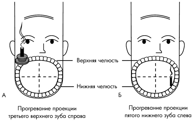 Су-Джок лечит. Мигрень, кашель, боль в спине, тяжесть в желудке