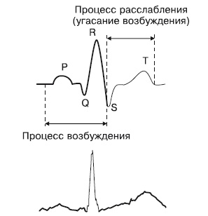 Что показывает кардиограмма