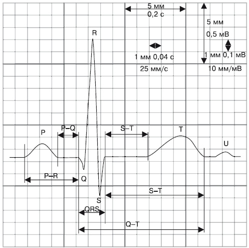 Что показывает кардиограмма