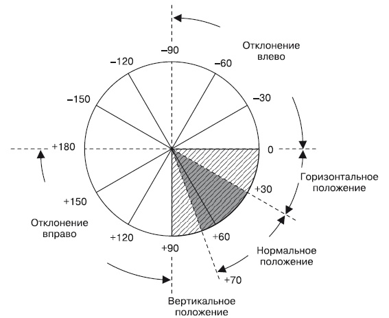 Что показывает кардиограмма