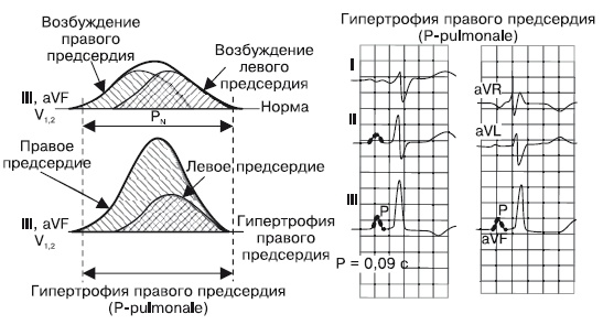 Что показывает кардиограмма