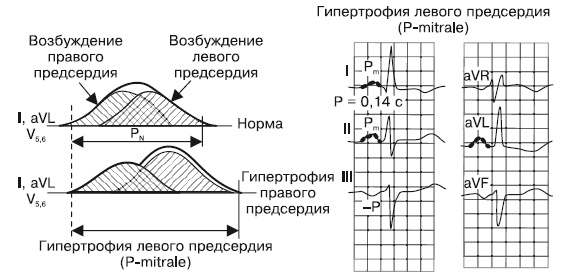 Что показывает кардиограмма