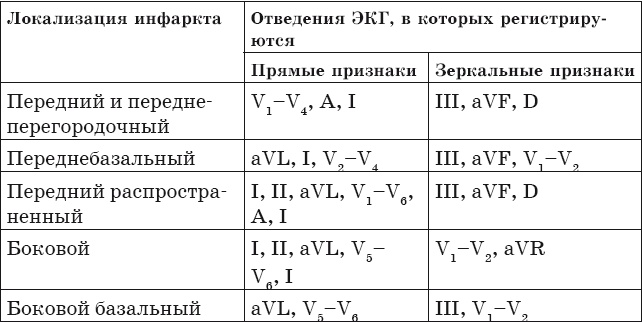 Что показывает кардиограмма