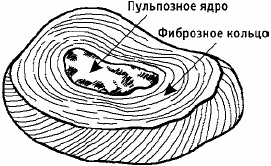 Заболевания позвоночника. Карманный справочник