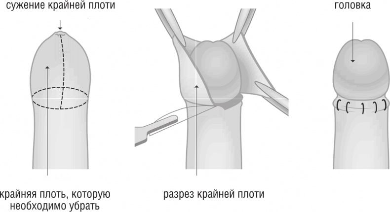 ОН. Интимный разговор про тот самый орган