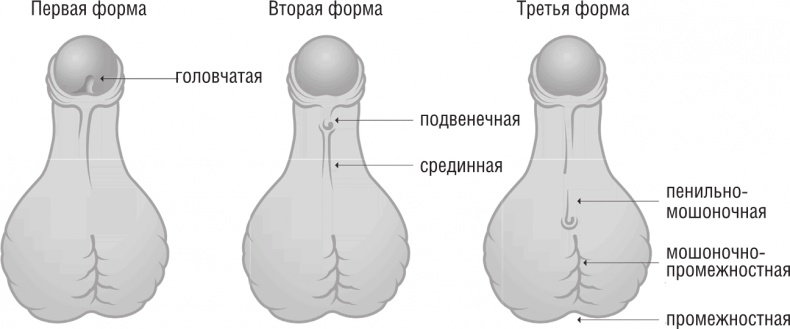 ОН. Интимный разговор про тот самый орган