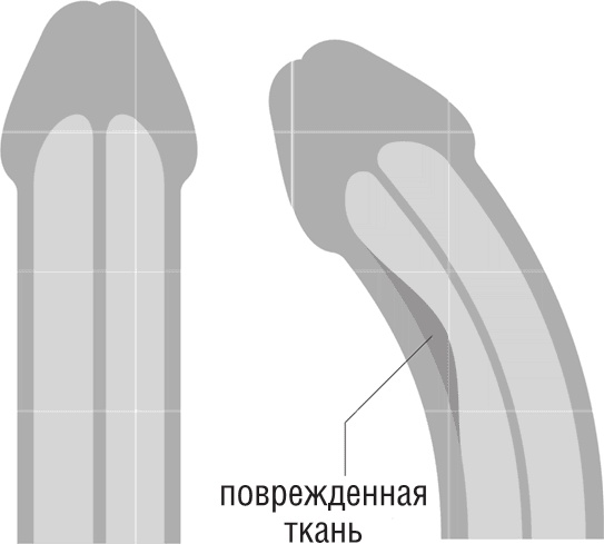 ОН. Интимный разговор про тот самый орган