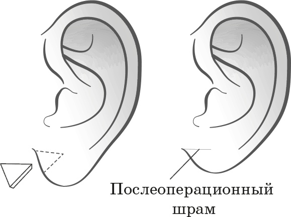 Как обмануть возраст