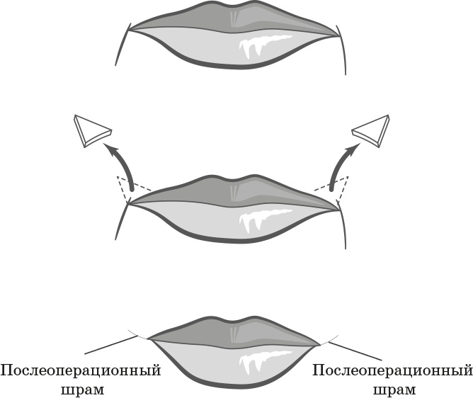 Как обмануть возраст