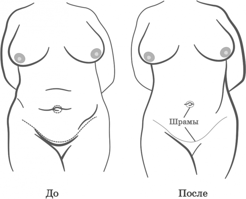 Как обмануть возраст