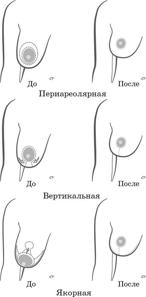 Как обмануть возраст