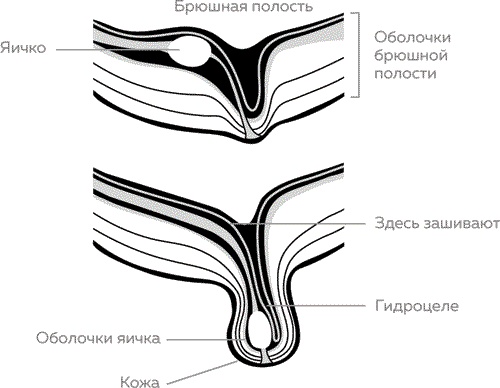 Мужское здоровье. Как у вас с ним?