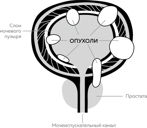 Мужское здоровье. Как у вас с ним?