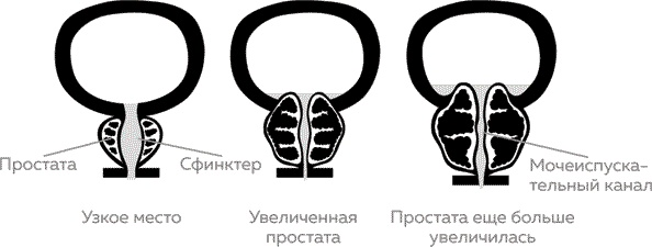 Мужское здоровье. Как у вас с ним?