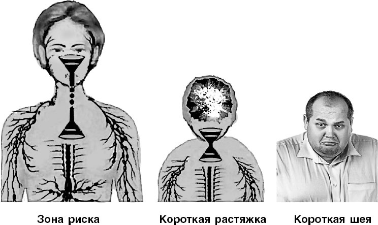 Система Осьмионика. Самомоделирование осанки. Коррекция верхней половины тела