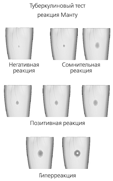 Как работает иммунитет