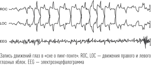 Загадки сна