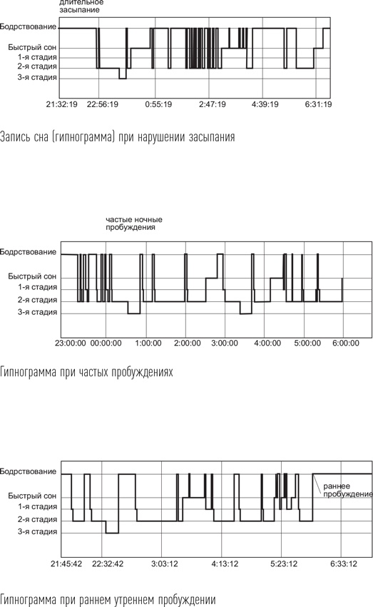 Загадки сна