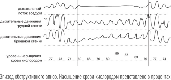 Загадки сна