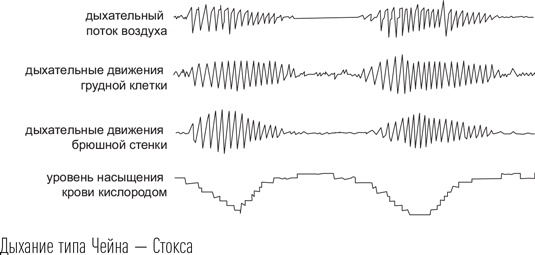 Загадки сна