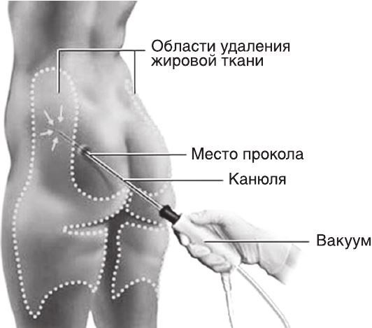 Кожа: мифы и правда о самом большом органе