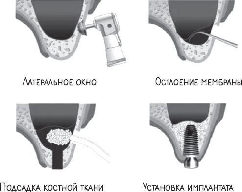 В лабиринтах уха, горла и носа. Скрытые механизмы работы, неочевидные взаимосвязи и полезные знания, которые помогут «дотянуть» до визита к врачу