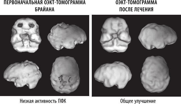 Полюби свой мозг