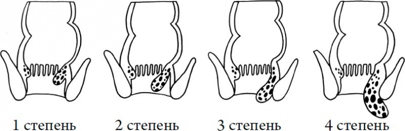 Человек Противный