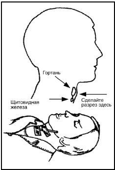 Выживание в экстремальных ситуациях. Опыт SAS