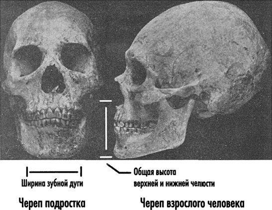 Естественное лечение кариеса. Реминерализация и восстановление зубов при помощи питания