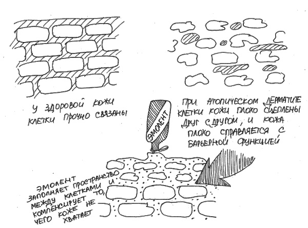 Аллергия и как с ней жить. Руководство для всей семьи