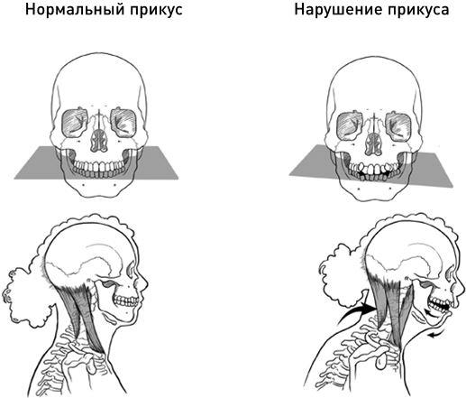 Челюсти. Научное исследование о взаимосвязи между зубами, мозгом и кишечником + 40-дневный план питания, который поможет вернуть в норму здоровье ротовой полости и сформировать иммунитет к кариесу