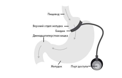 Код диабета. Научные данные о том, как диабет 2-го типа стал самой «внезапной» болезнью столетия, и простая программа восстановления без инъекций и лекарств