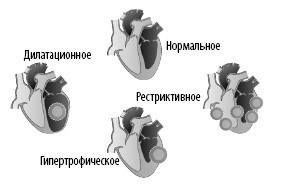 Взламывая анатомию