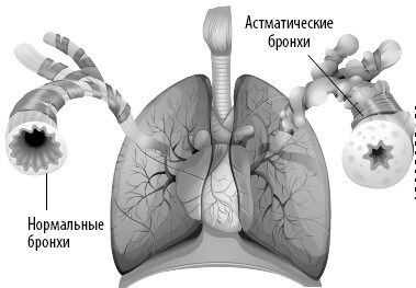 Взламывая анатомию