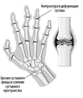 Взламывая анатомию