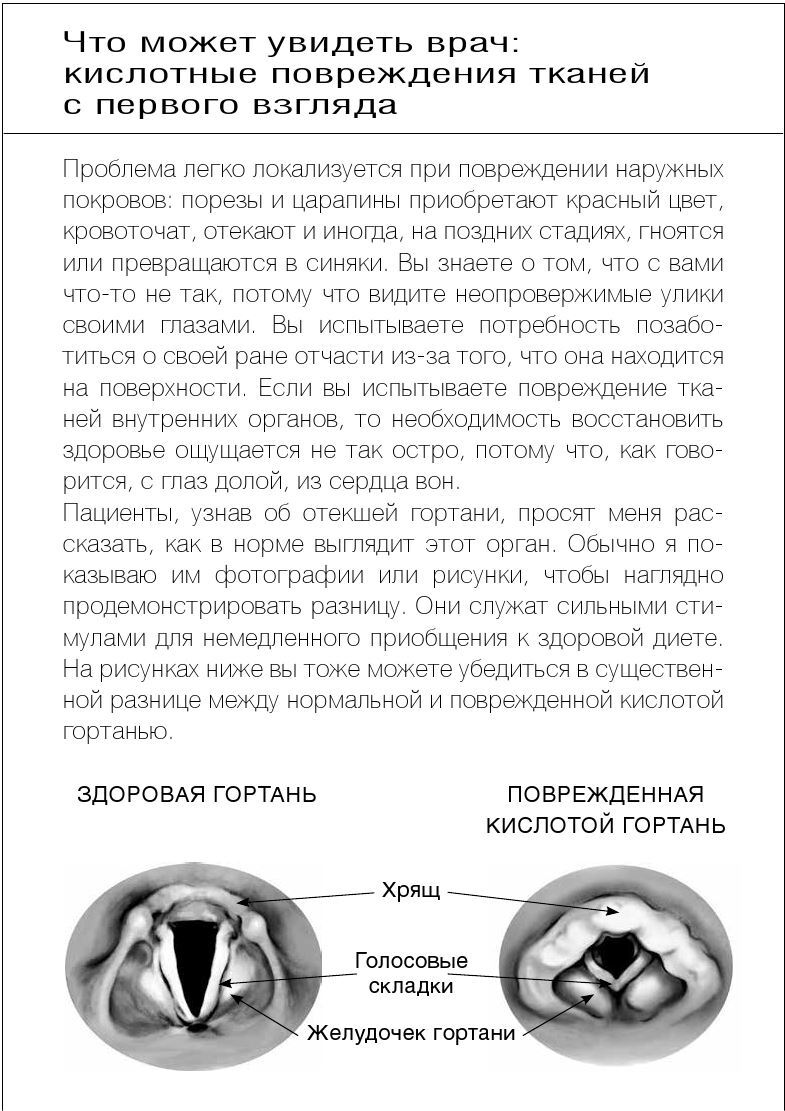 Как вылечить изжогу, кашель, воспаление, аллергию, ГЭРБ : программа снижения кислотности за 28 дней